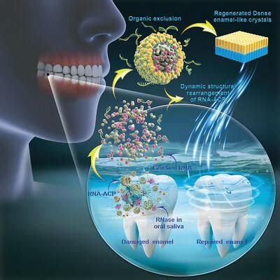 Keratin-Based Enamel Repair