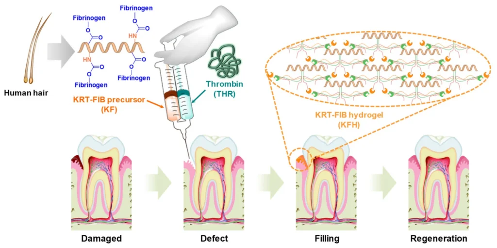Keratin-Based Injectable Hydrogel for Oral Tissue Regeneration